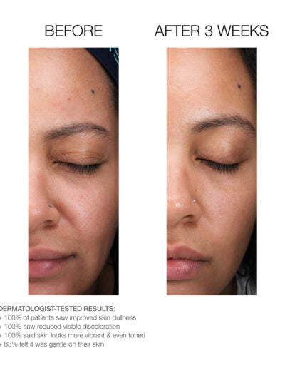 Gloss, Resurfacing serum with Lactic Acid