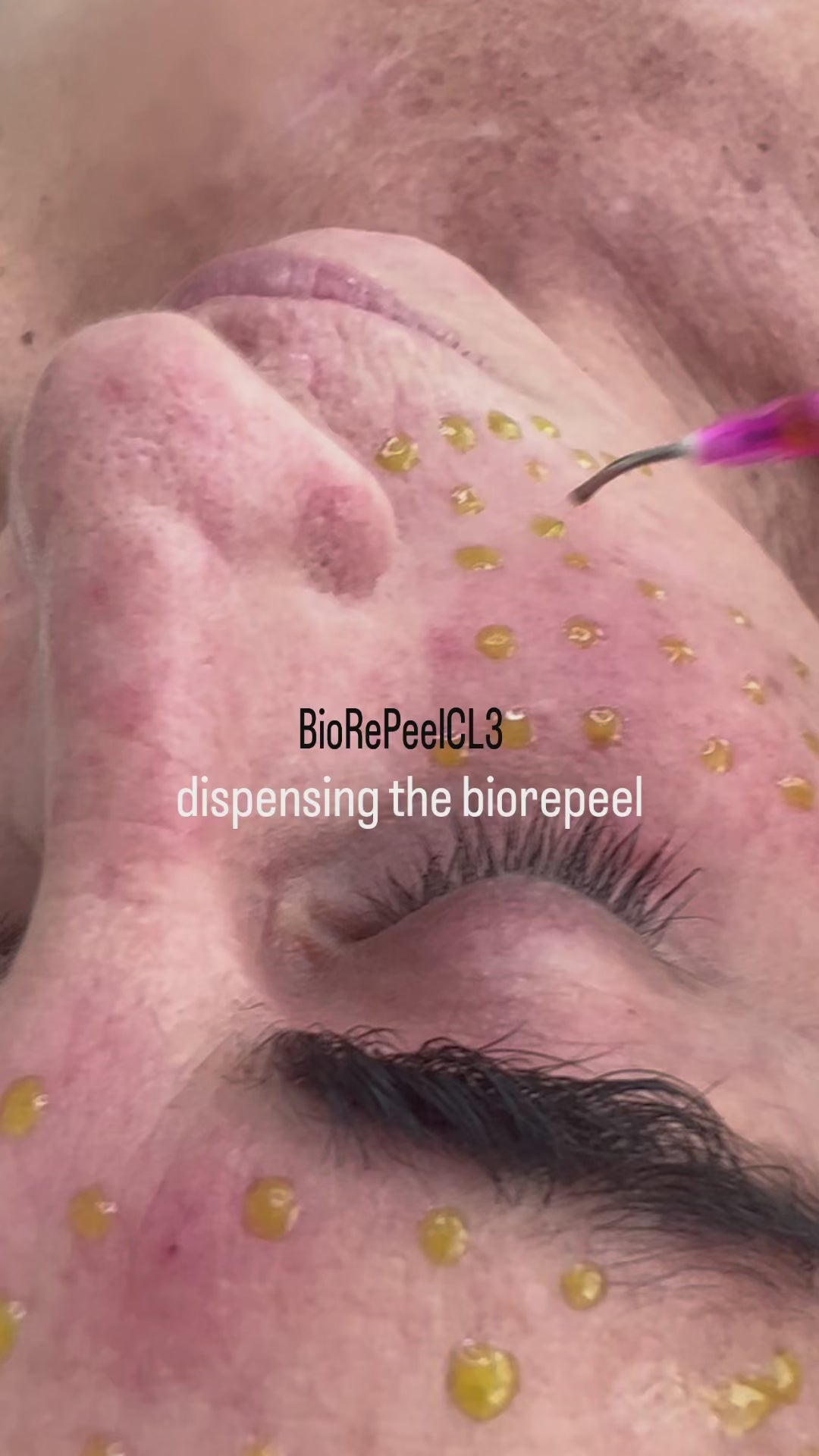 BioRePeel CL3