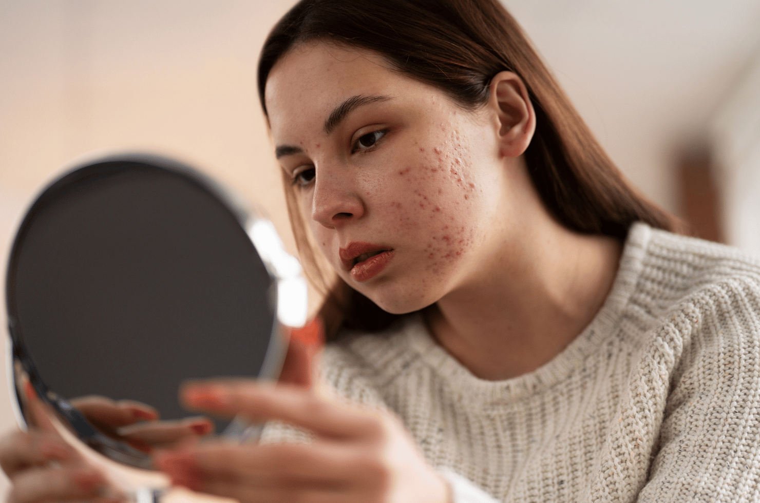 How to Get Rid of Rosacea: Your Complete Guide to Clearer Skin