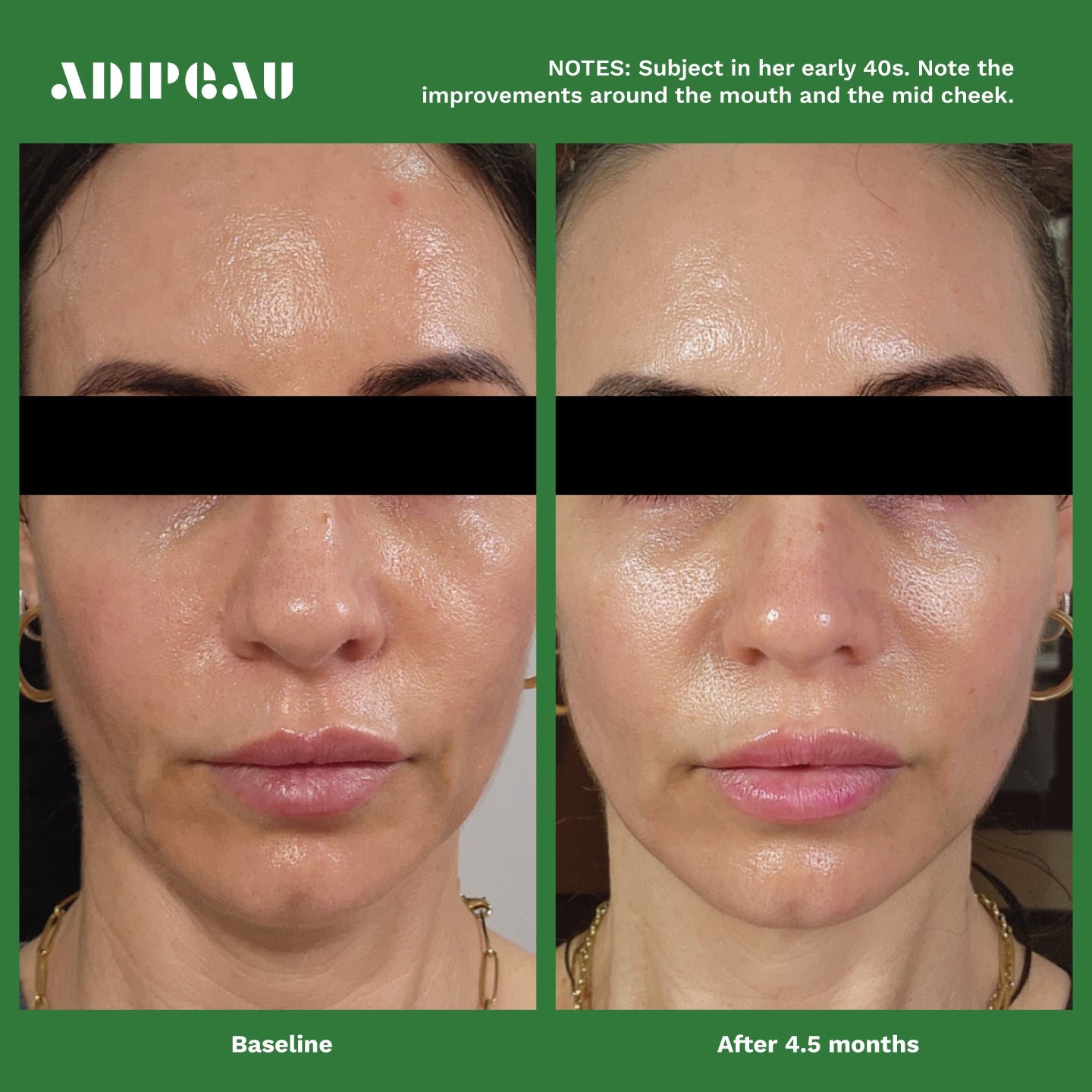 Adipeau Active Cream