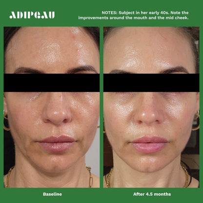 Adipeau Active Cream