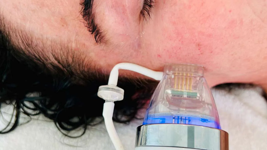 RF MICRONEEDLING - ME2 BEAUTY