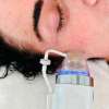 Micro-Needling  with Premium Skin Booster