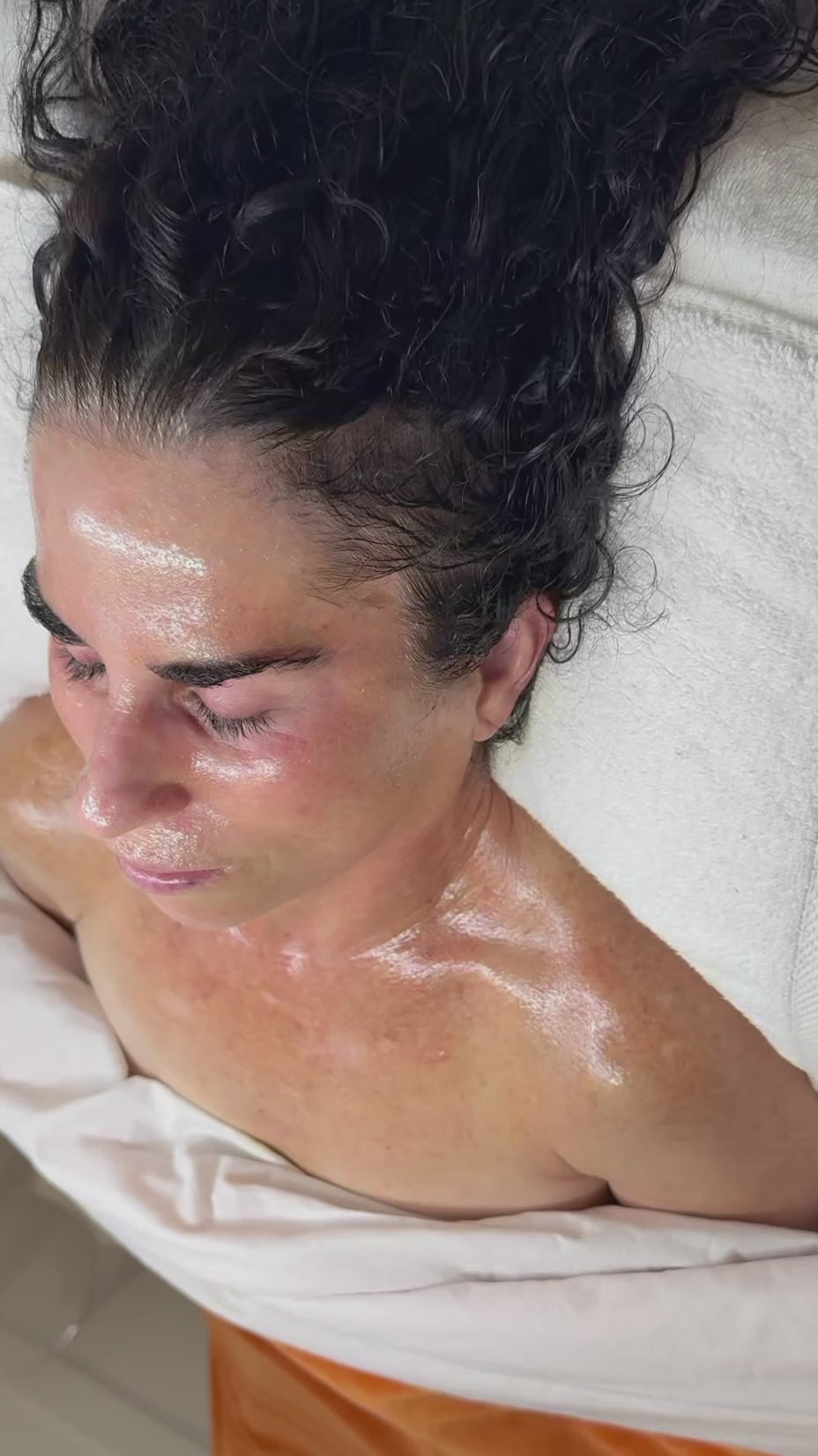 Skin Perfector Medical Peel