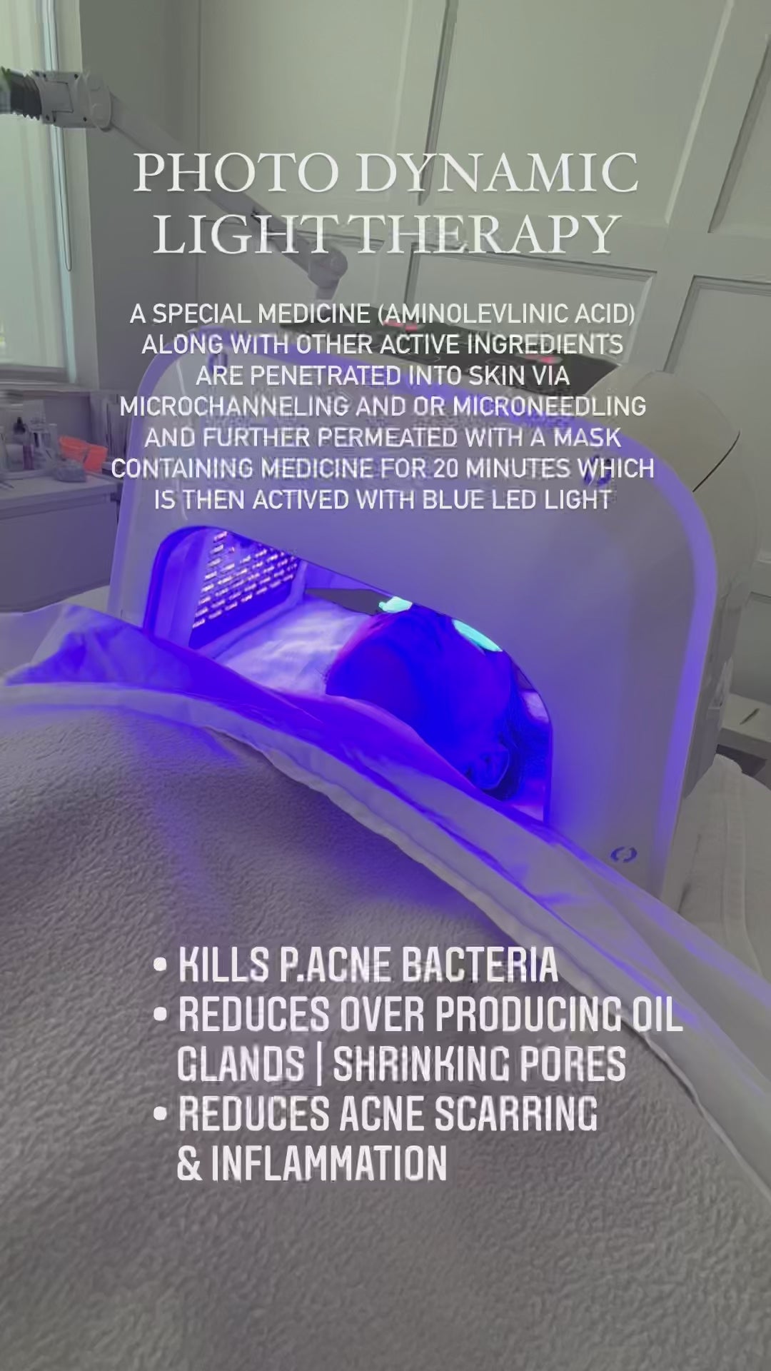 PHOTO DYNAMIC ACNE TREATMENT