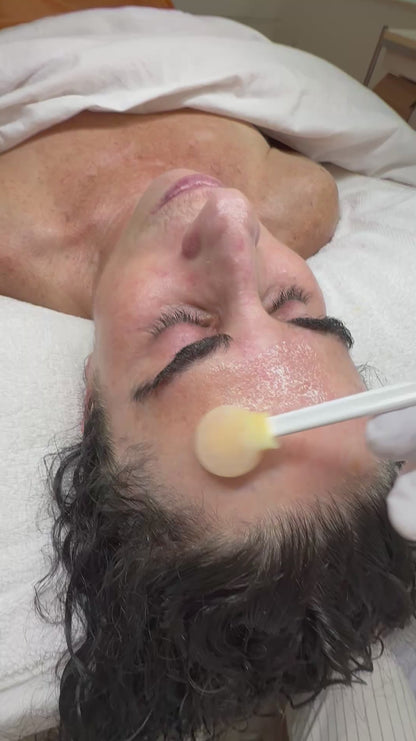 Skin Perfector Medical Peel